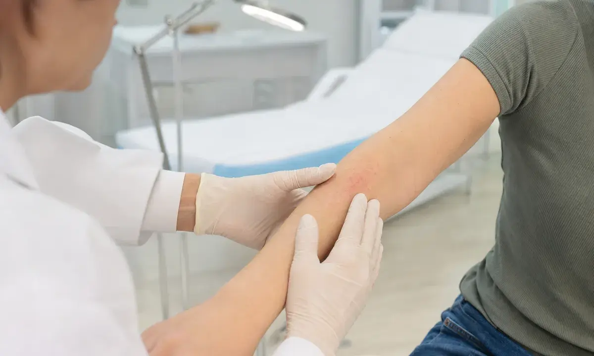 Medico con guanti esamina un lieve arrossamento sull’avambraccio di un paziente in ambulatorio